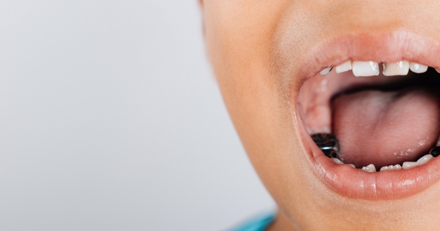 why stainless steel crowns are a game-changer for primary teeth